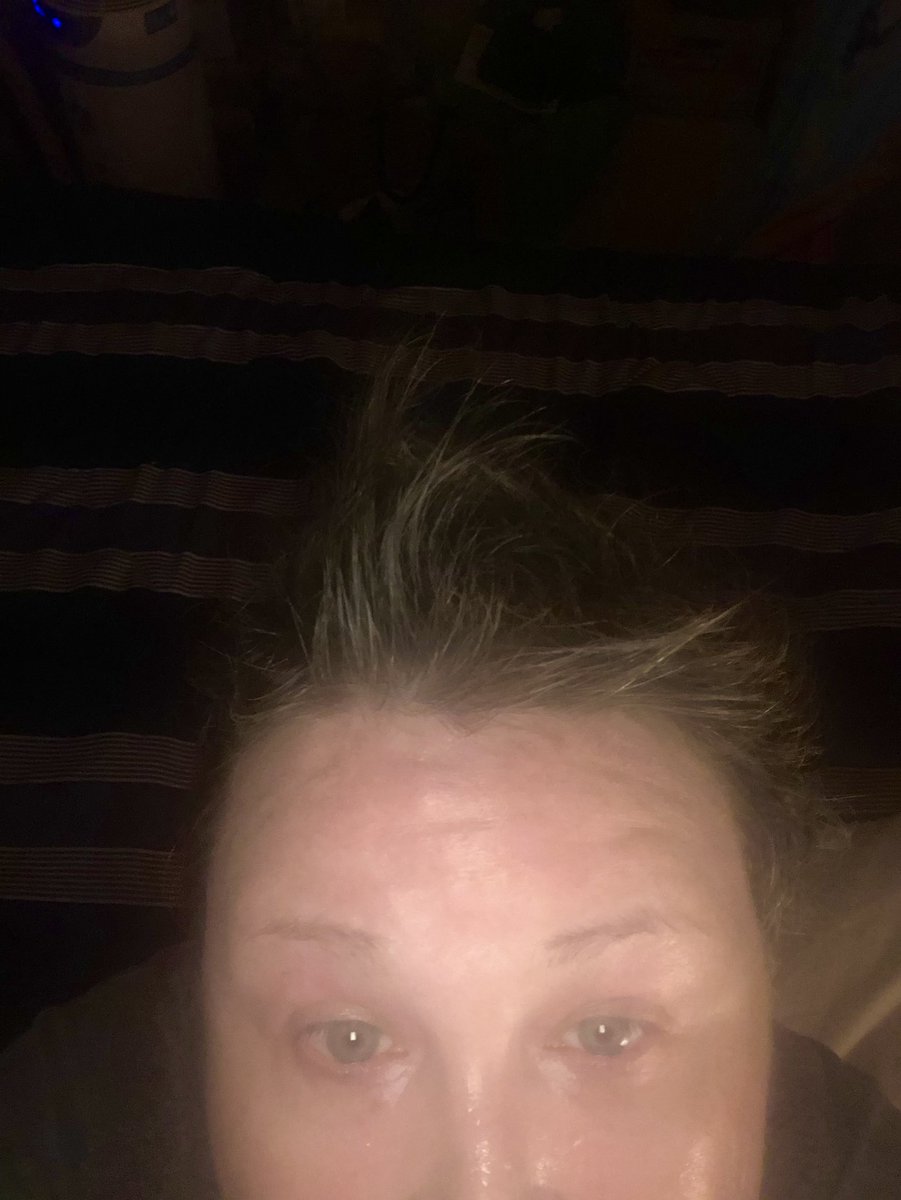 pointnopoint77's tweet photo. Well geez, my #postcancer hair is at that awkward phase where I permanently look like I’m in a #windtunnel. Thankfully I’m getting a #haircut next week. P.S. Check yourself regularly for breast lumps. Last year doing that saved my life. #BreastCancerAwarenessMonth #hairraising https://t.co/1TfIPasPFW