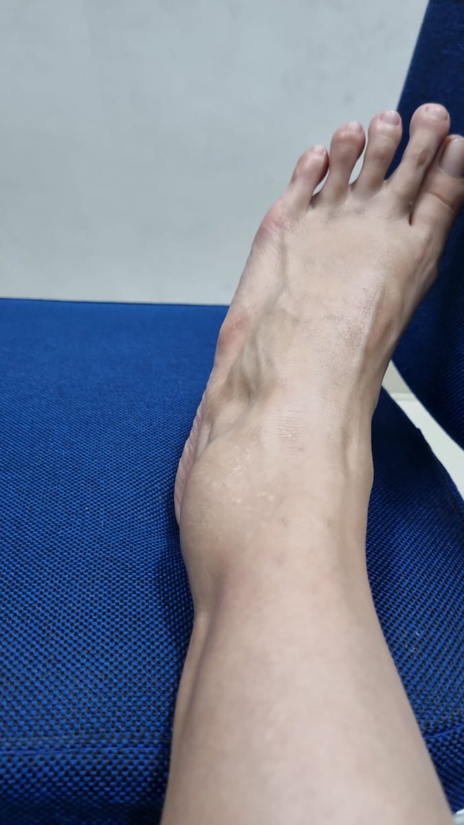 <a href="/CommuterLine/">KAI Commuter</a> <a href="/bptj151/">BPTJ 151</a> <a href="/KAI121/">Kereta Api Indonesia</a> gak tau mau mention siapa lagi. Mau nunggu berapa orang lagi jatuh ke celah peron di Stasiun Manggarai?? Jarak gerbong ke peron tuh jauh banget di Manggarai. Teman saya jatuh, kakinya gak bisa jalan sekarang. TANGGUNG JAWAB!