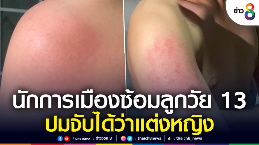 ล่าสุดมีข่าวนี้ น้องลูกนักการเมืองคนนึงโดนพ่อทำร้ายเพราะจับได้ว่าน้องแต่งหญิง เลยทำร้ายน้องจนน้องวิ่งหนีออกจากบ้านมา น่าสงสารน้องมาก ลูกตัวเองแท้ๆ ทำกันถึงขนาดนี้ ㅠ_ㅠ