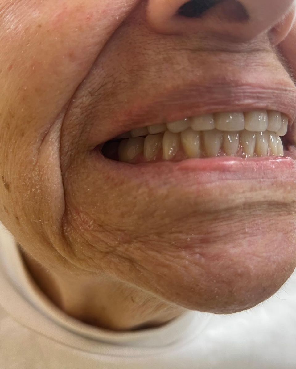 TouroDental's tweet photo. #TCDM D4 students partners Sameer Bilal & Sang Jun Nam delivering a full upper and lower denture🦷 (Patient consented to take all the pictures)
#dentistryworld #dentalclinic #dentist #smile #smilemore #dental
#dentalhealthtips #dentalsolution #dentalcare #dentistry https://t.co/MCk7FSulPj