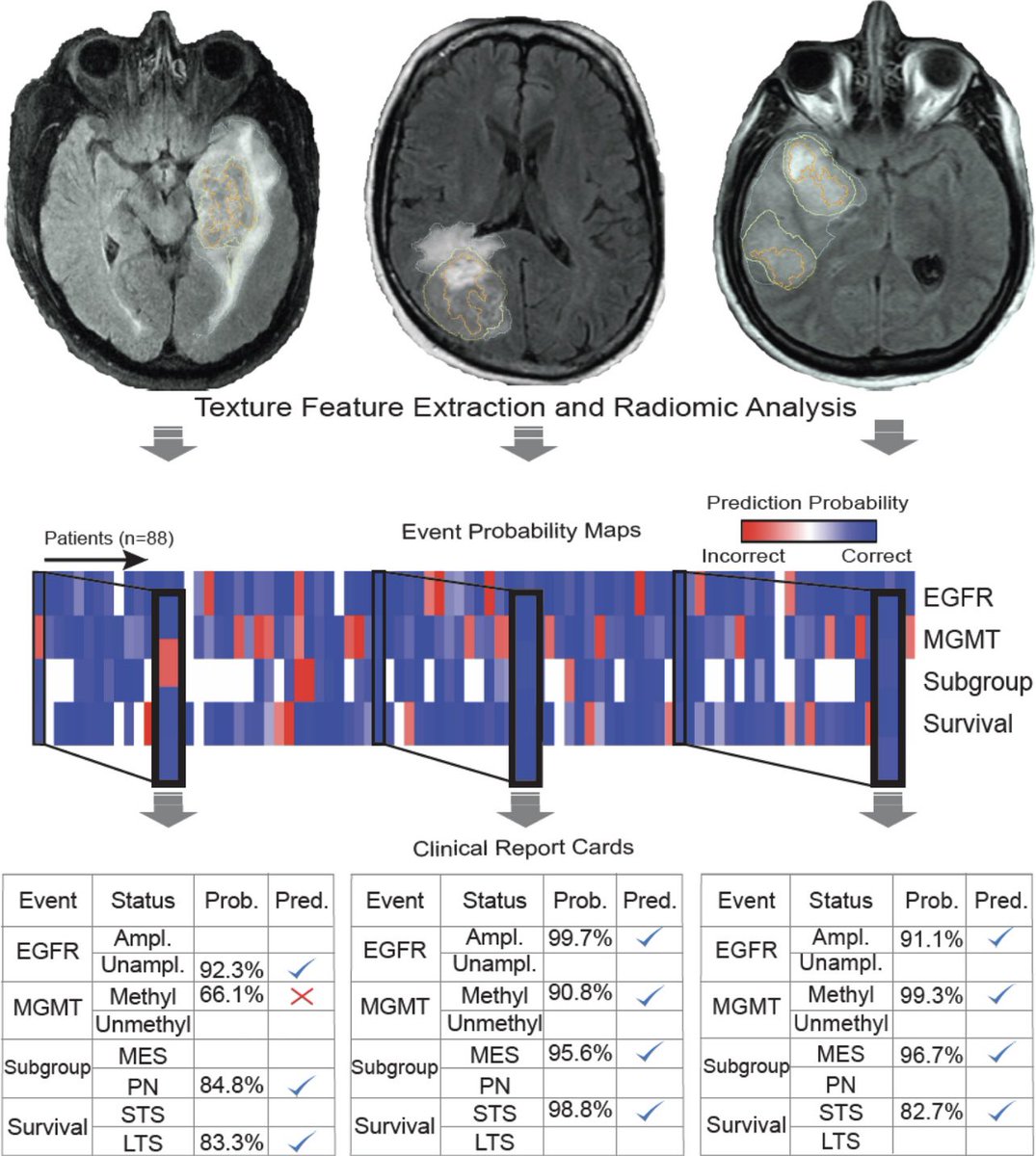 Pascal Zinn, M.D., Ph.D., FAANS (@pascalzinn) on Twitter photo Strong work team! Congrats! <a href="/PittNeurosurg/">Pitt Neurosurgery</a> <a href="/UPMCHillmanCC/">UPMC Hillman Cancer Center</a> <a href="/UPMC/">UPMC</a> <a href="/PittTweet/">University of Pittsburgh</a> link.springer.com/article/10.100… Personalized radiogenomic patient report cards!😎 Strong work team! Congrats! <a href="/PittNeurosurg/">Pitt Neurosurgery</a> <a href="/UPMCHillmanCC/">UPMC Hillman Cancer Center</a> <a href="/UPMC/">UPMC</a> <a href="/PittTweet/">University of Pittsburgh</a> link.springer.com/article/10.100… Personalized radiogenomic patient report cards!😎