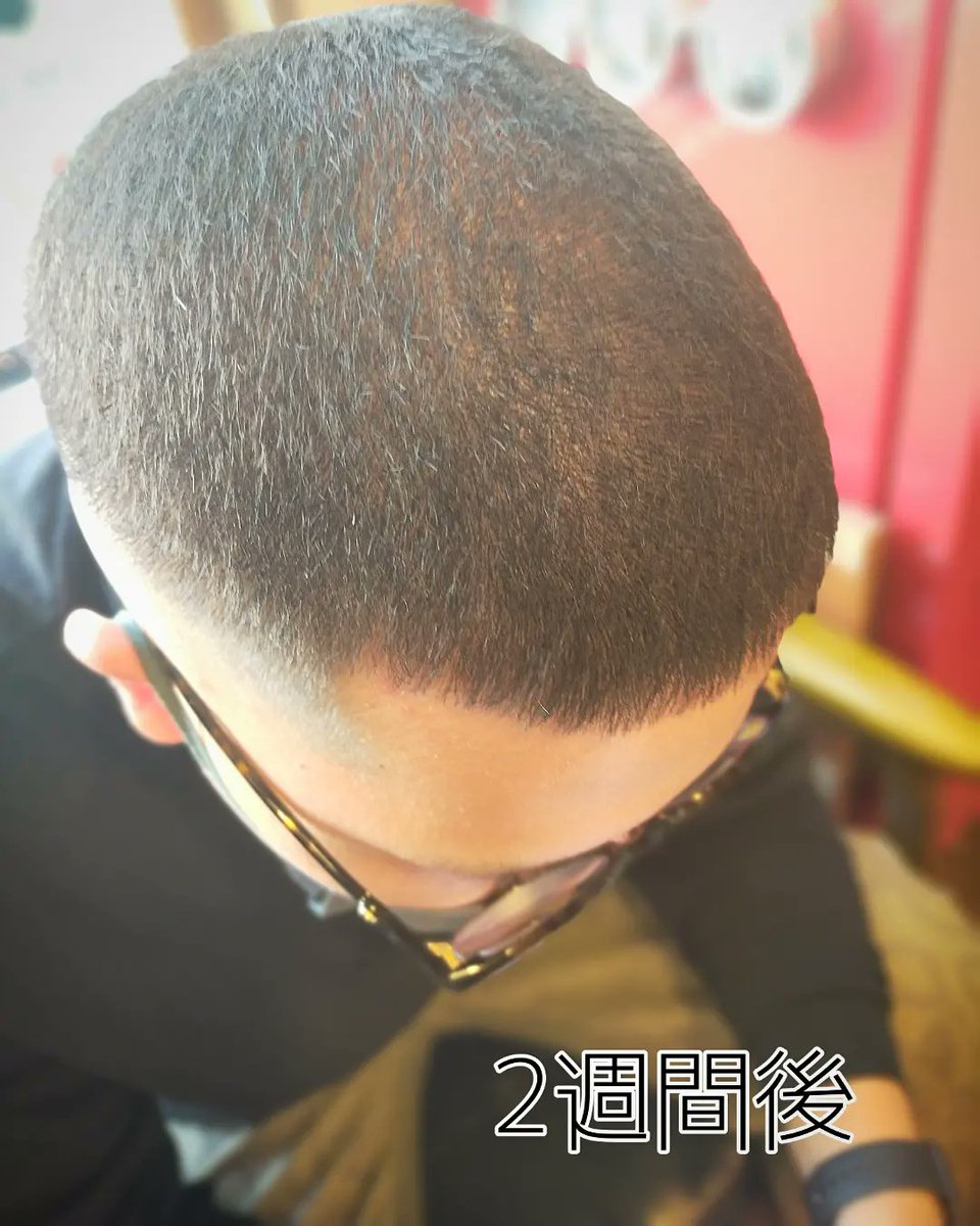 barber_yoshioka's tweet photo. 個性有り easyperm
イージーパーマは施術直後のPIC①の状態から、PIC②の状態へと変化します。髪質が変わったのような感覚・経過を楽しめます。最終形態はまるでバズニグロのようで、理髪師(私)も思わずかっこいいと感じるスタイルです!
#イージーパーマ #easyperm
#スキンフェード #メンズカット https://t.co/j7EELTA7Z1