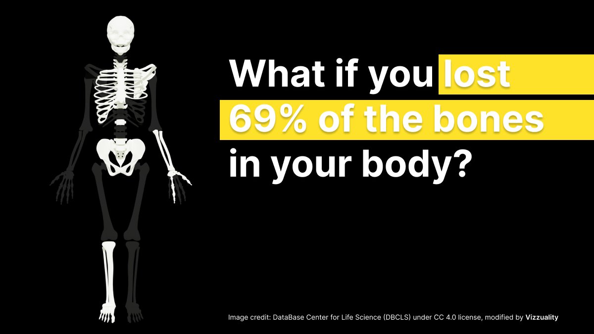 Would your skeleton still be able to support your body?

The <a href="/WWF/">WWF</a> Living Planet Report warns that since 1970 we have lost 69% of wildlife on average - the planet’s biodiversity backbone.

#ForALivingPlanet #LivingPlanet #LPR2022
