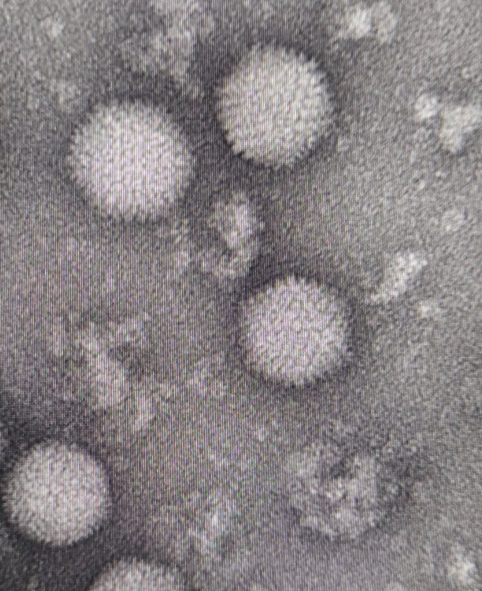 Adenovirus research group_Ruder Boskovic Institute (@adenoteam) on Twitter photo Thanks to <a href="/institutrb/">Ruđer Bošković Institute</a> and <a href="/hrzz_science/">Croatian Science Foundation</a> funding support Davor Nestic went to <a href="/CNB_CSIC/">Centro Nacional de Biotecnología (CSIC)</a> to do some exciting sience with <a href="/carmensmp/">Carmen San Martín</a> and her amazing team. Here is a sneak peek on HAdV-D26 EM negative staining. <a href="/DragomiraMajhen/">Dragomira Majhen</a> Thanks to <a href="/institutrb/">Ruđer Bošković Institute</a> and <a href="/hrzz_science/">Croatian Science Foundation</a> funding support Davor Nestic went to <a href="/CNB_CSIC/">Centro Nacional de Biotecnología (CSIC)</a> to do some exciting sience with <a href="/carmensmp/">Carmen San Martín</a> and her amazing team. Here is a sneak peek on HAdV-D26 EM negative staining. <a href="/DragomiraMajhen/">Dragomira Majhen</a>