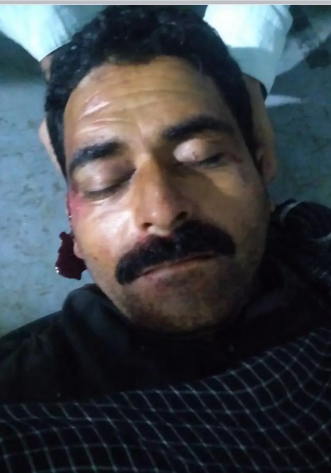 HaiderMir0555's tweet photo. #DIGKPK #DPOMansehra #DCMansehra is Bahi k Katil griftar karooo @cmkpkmehmoodkha
@DIG_MakhdoomQB https://t.co/yhhWXB3YJs