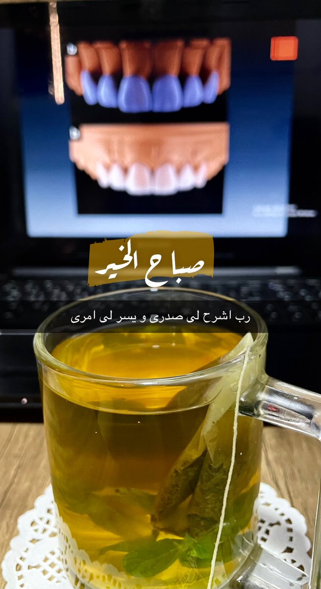 DrMohammedRefae's tweet photo. جمعة مباركة🥰
#صباح_الخيرᅠ #جمعة_مباركة 
#صفوة_المهيدب_لطب_الاسنان #تجميل #ابتسامة_هوليود #اسنان #ايماكس #فينيرز #عدسات #تركيبات_اسنان #سكاكا #الجوف 
#safwatalmuhydb #dentist #dental_clinic #smile #smilemakeover #sakaka #aljouf #veneers_smile #crown #emax #emaxveneers #aesthetic https://t.co/60YbkoyPBb