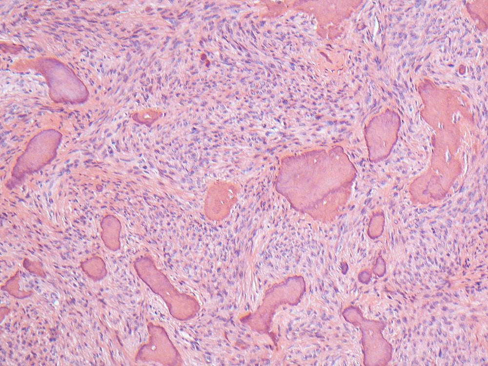 Oral Path Opinion tweet media