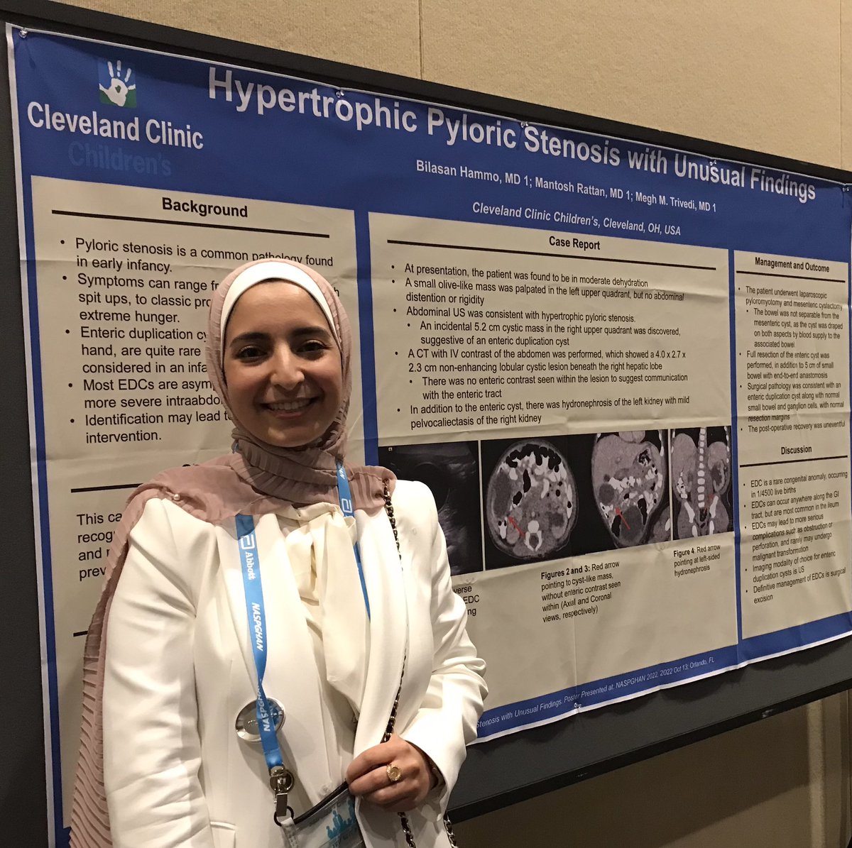 Karen Murray (@karenmurraymd) on Twitter photo Dr. Bilasan Hammo, Peds Chief Resident <a href="/CleClinicKids/">Cleveland Clinic Children’s</a> presents an unusual case of pyloric stenosis at NASPGHAN annual meeting- we are so proud! Dr. Bilasan Hammo, Peds Chief Resident <a href="/CleClinicKids/">Cleveland Clinic Children’s</a> presents an unusual case of pyloric stenosis at NASPGHAN annual meeting- we are so proud!