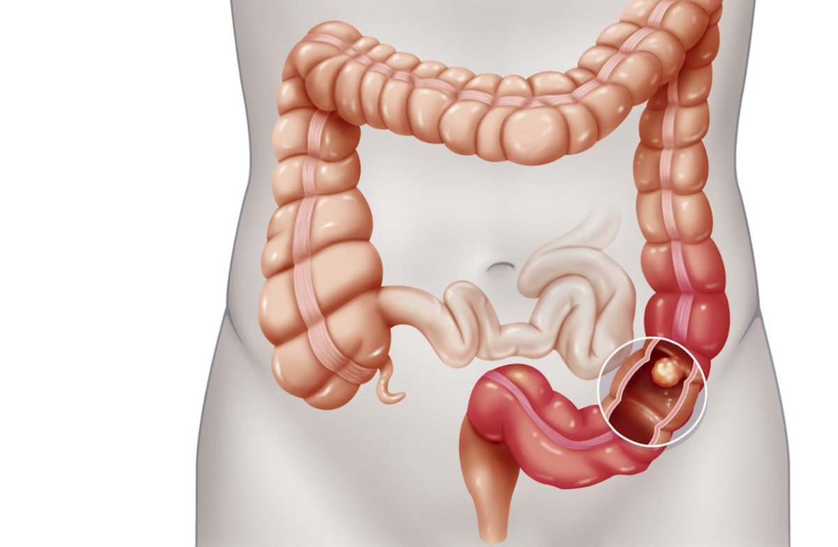 CNN en Español tweet media