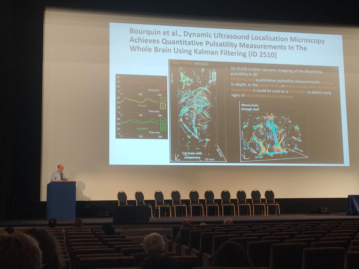 ProvostLab's tweet photo. Chloé (@ChloeBourquin) presented how Kalman filtering could help to perform quantitative pulsatility measurements in the whole brain using 3D Dynamic Ultrasound Localization Microscopy (3D DULM) 🐱
Her work was part of the highlights of the conference. https://t.co/gauh44ChFk