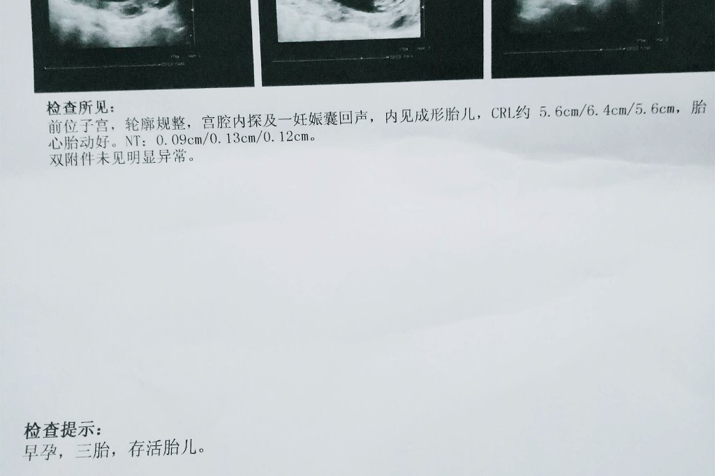 多子多福，恭喜呀，妈蛋的大家都不说别人才不管是不是你这个亲爹生的呢！很难得啦，老鸡巴们种子肯定不好啦，但是你家的地好呀，坐等开花结果啦！ https://t.co/s6ieSuzVY1