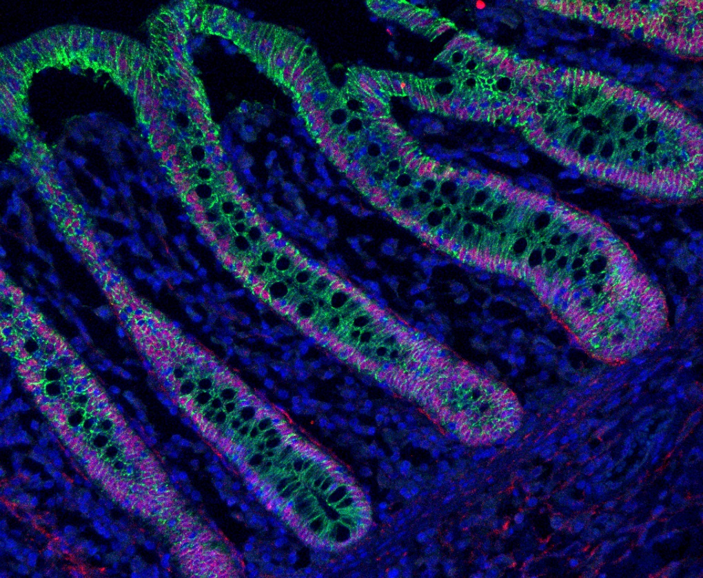 Muneralab's tweet photo. Human colon biopsy #FluorescenceFriday #organoids #humanintestinalorganoids #microscopy #cellbiology #sciart #bioart https://t.co/mmd2pZYmNV