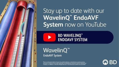 aacuna14's tweet photo. The BD WavelinQ™ EndoAVF System playlist has tons of great resources to learn more about EndoAVF! Visit the playlist today and subscribe to the BD channel to stay up to date on all of the latest innovations. https://t.co/I7OhJMZ5ZZ #BDemployee https://t.co/2to1RKqwA3 https://t.co/jIZXrE6Y1T
