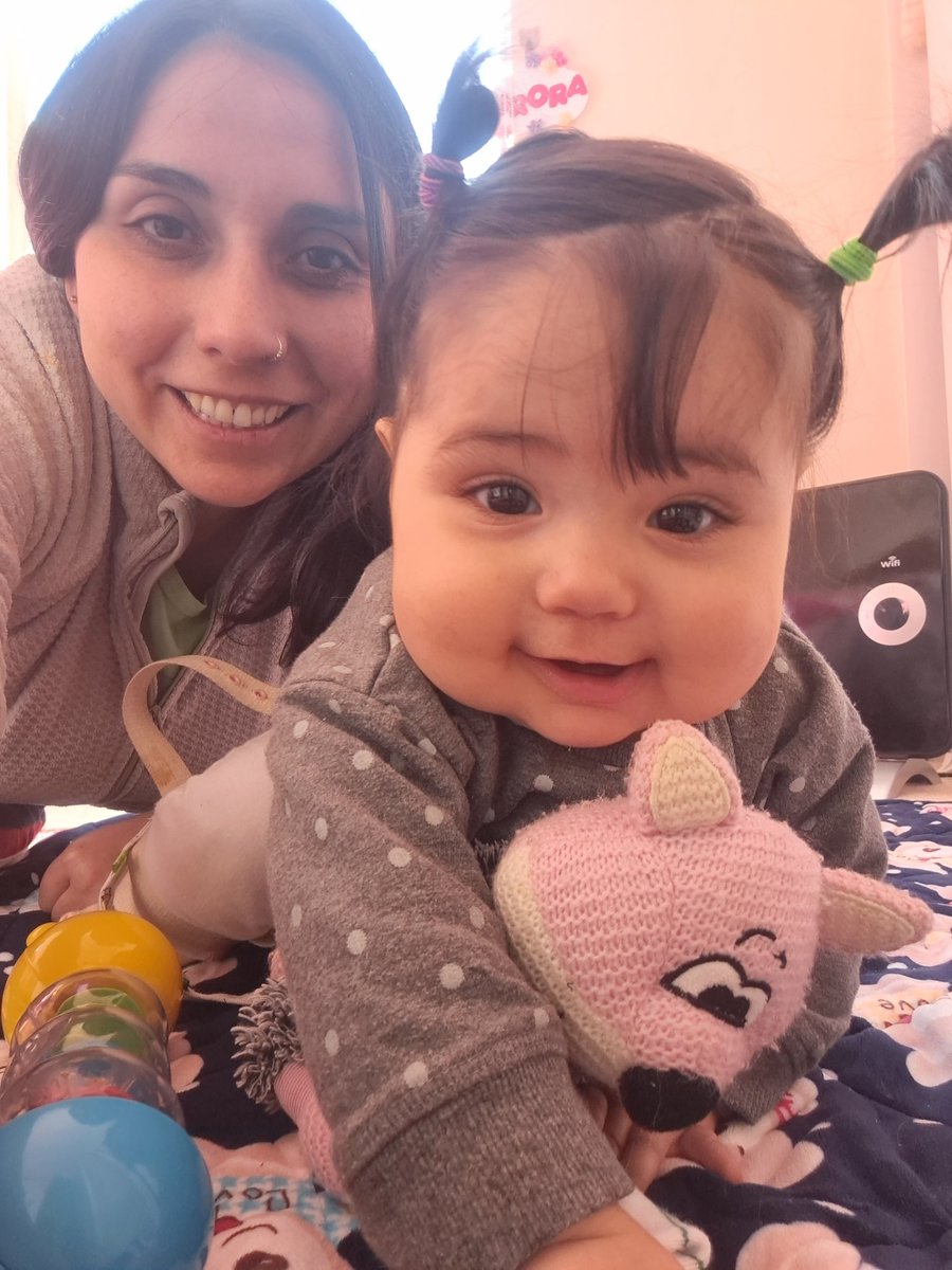 ValedeValentin1's tweet photo. Lo concreto. Dejarías a tu hijx de 6m con #displasiadecaderas con tto 24/7 en la sala cuna?. La licencia de cuidado es solo con subluxación de la artic. Por más disposición y preocupación de las tías, los mejores cuidados son con sus ma/padres #ExtensionPostnatalParental https://t.co/mj83tNCJU0
