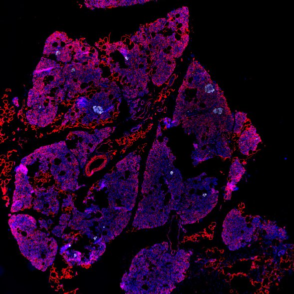 The most extensive image bank of samples of the pancreas from children who developed #diabetes shortly before death has gone live, with the aim to advance global medical research in the diabetes field.

Find out more: exeter.ac.uk/news/research/…