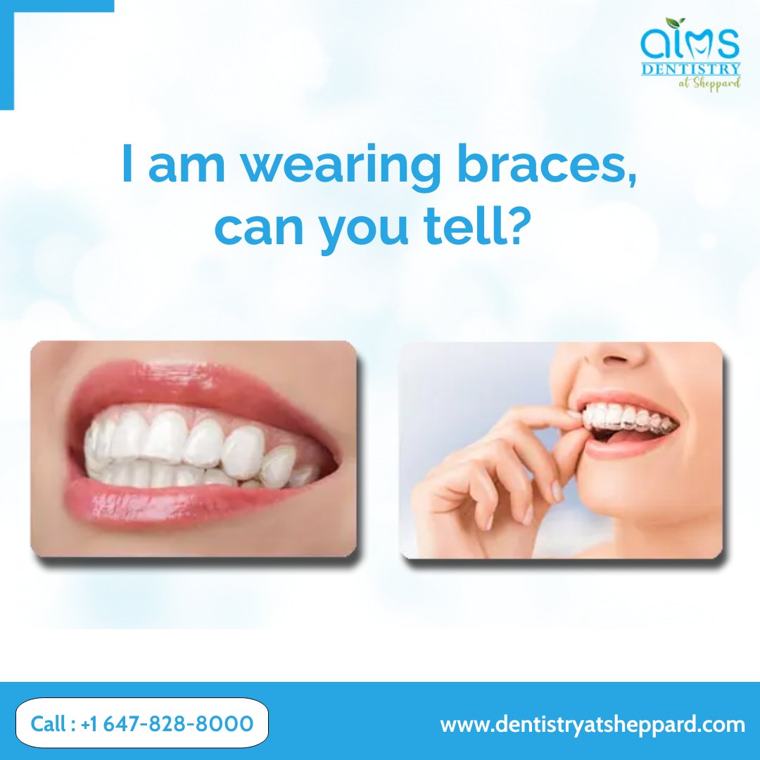 aims_sheppard's tweet photo. With Invisalign, only the results and not your aligners will be visible! The fastest and most convenient way to align teeth without traditional braces. Need to know more? 

Get in contact with us today. 

#AIMS #aimsdentistrysheppard #dentistry #dentist https://t.co/GxOGffOlrz