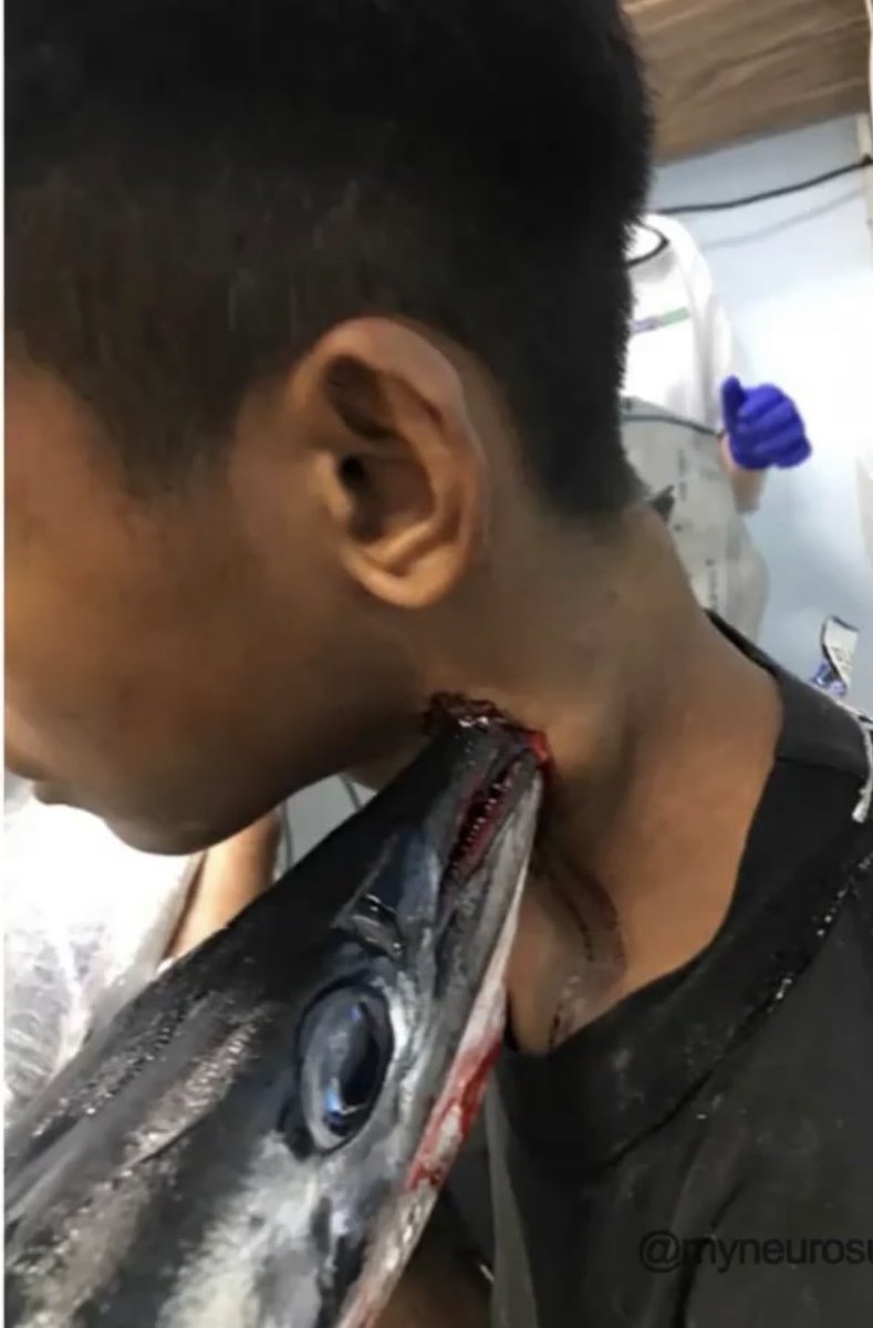 OGdukeneurosurg's tweet photo. How would you manage this patient? Source: myneurosurgery https://t.co/m97QoHs10M
