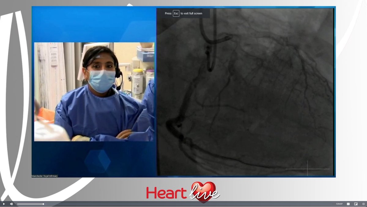 Millbrook Medical Conferences (@millbrookmed) on Twitter photo If you joined us for #HeartLive last week, or want to see what you missed, you can now access all #HeartLive sessions and cases on demand!
If you're registered to the Hub, view the conference here: crowdcomms.com/mmc/modules/14…
Register for the Hub: millbrook-medical-conferences.co.uk/Forms/Millbroo…
<a href="/ford1102/">Farzin Ordoubadi</a> If you joined us for #HeartLive last week, or want to see what you missed, you can now access all #HeartLive sessions and cases on demand!
If you're registered to the Hub, view the conference here: crowdcomms.com/mmc/modules/14…
Register for the Hub: millbrook-medical-conferences.co.uk/Forms/Millbroo…
<a href="/ford1102/">Farzin Ordoubadi</a>