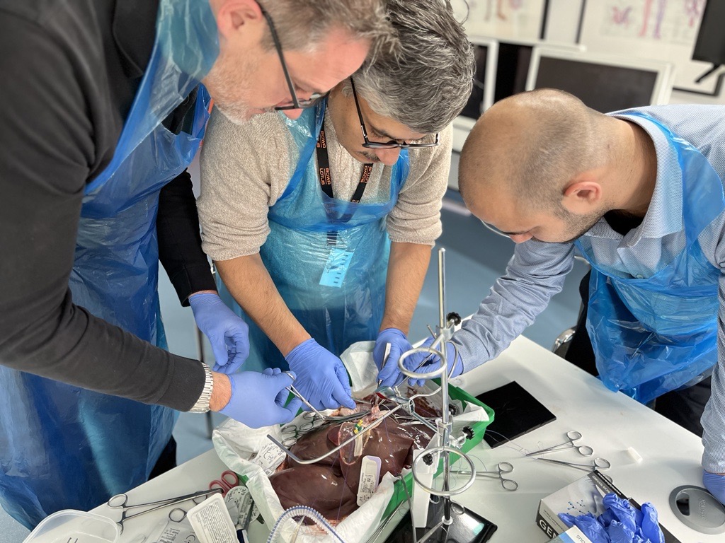 BOWAMEDICALUK's tweet photo. The second practical session gave the Delegates the opportunity to practice Hepaticojejunostomy on our wetlab models. The "Basics of Liver Surgery Course" will also cover the MDT Liver Cases Discussion and valued feedback before the end of the day. #GBIHPBA #AUGIS #ROUXGROUP #HPB https://t.co/er6yhlRt7A