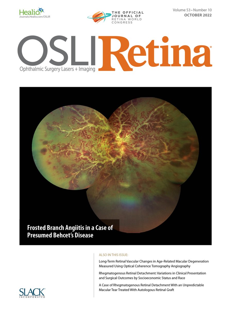 OSLIJournal's tweet photo. Have you seen the October issue of OSLIR?
Check it out now:
https://t.co/xJ5gtSK5jb
#ophthalmology #retinaworldcongress #OSLIR https://t.co/zwPM6TMEm9