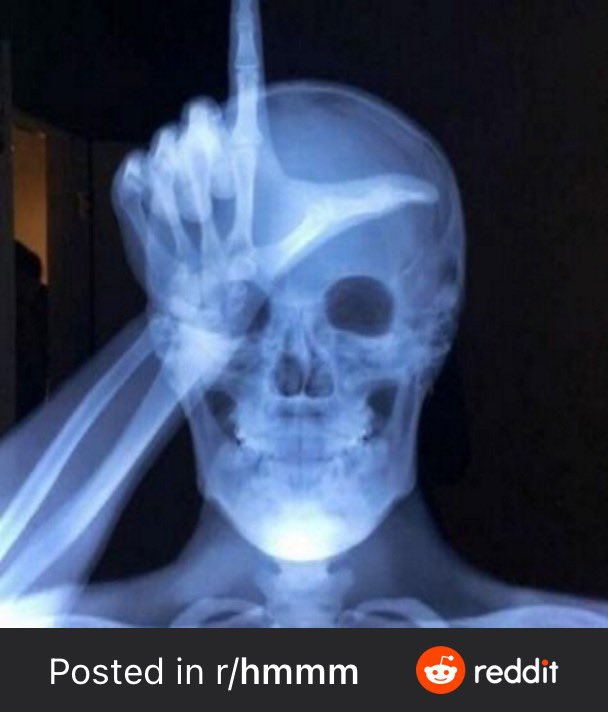 uusaint's tweet photo. In six words or fewer, write a story about this picture. ๐๐ฉป
#WritingCommunity
#sixwordstory
#amwriting
#ChallengeAccepted
#fridaymorning
#ellyeah https://t.co/5JwOlBinoY