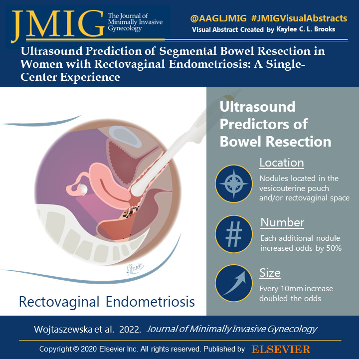 Check out this great article!

A recent study was done assessing transvaginal ultrasound predictors of bowel resection in women with rectovaginal endometriosis. 

#JMIGVisualAbstract #Endometriosis #EndometriosisResearch #BowelEndometriosis #MIGS #AAGL #MinimallyInvasiveSurgery