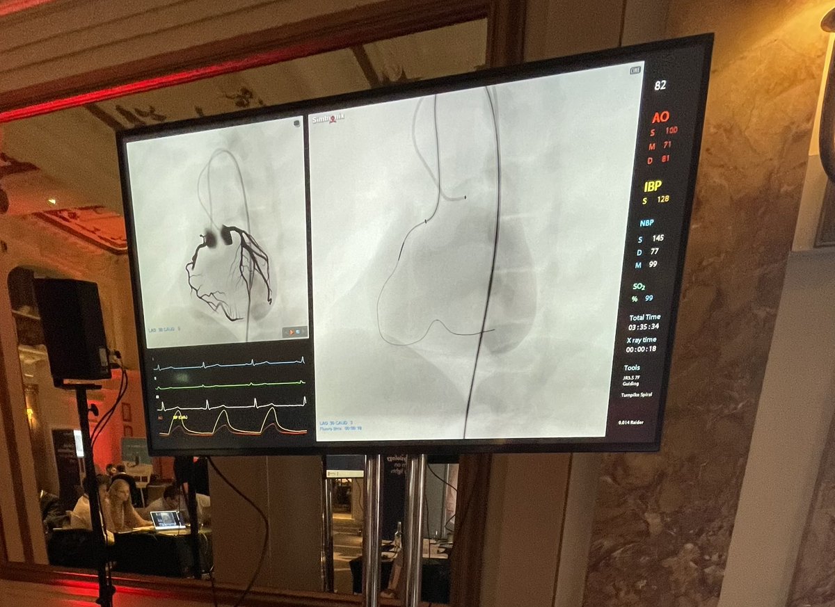 chapdoc1's tweet photo. #OptimalPCI fellows day had hands on experience in bifurcation techniques, CTO, IVUS, OCT, IVL, Laser, physiology and teaching from leading operators including the Rotamonster. Incredibly useful. Massive thanks to the organisers, sponsors and faculty #cardioed https://t.co/bJrfS6Ggu7