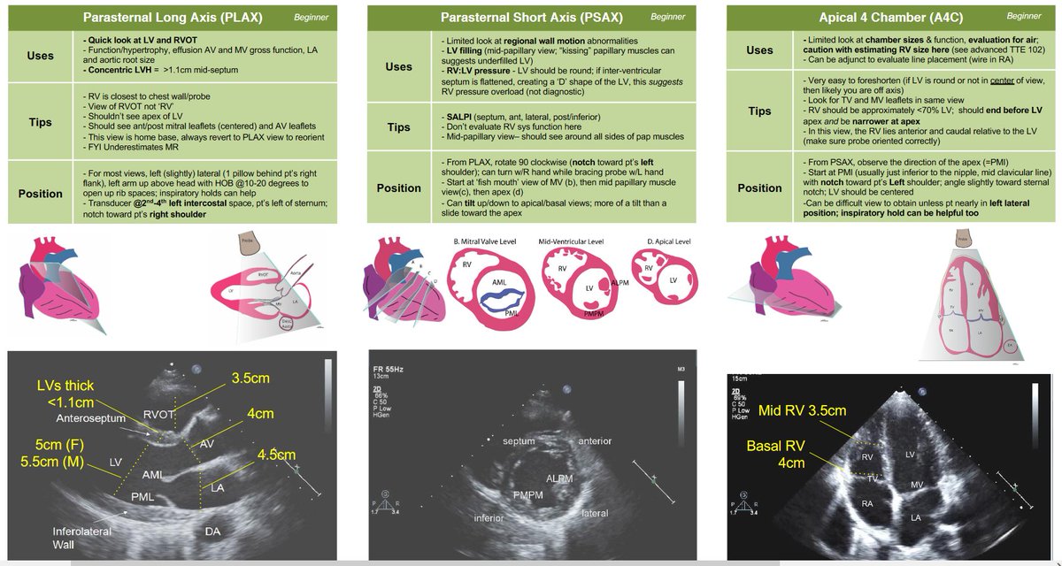 NephroP's tweet photo. Nice #POCUS #echofirst pocket card for beginners by UCSF #anesthesia 
👇 is only a PART of the card. 🔗to COMPLETE card: https://t.co/fkZ6vqeaqx
#MedTwitter #Nephrology https://t.co/xofTFv37O9