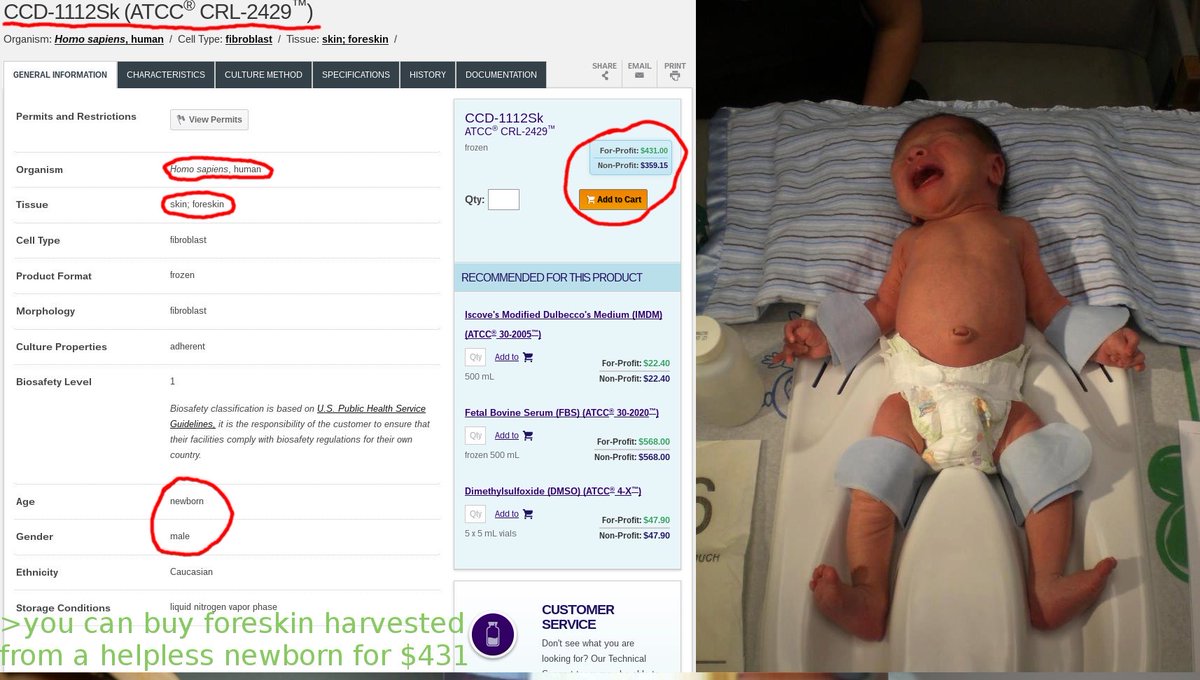 nonprophaetwo's tweet photo. @Dougvember @JackPosobiec These ghouls even sell foreskins. https://t.co/h0KCLoA7m6