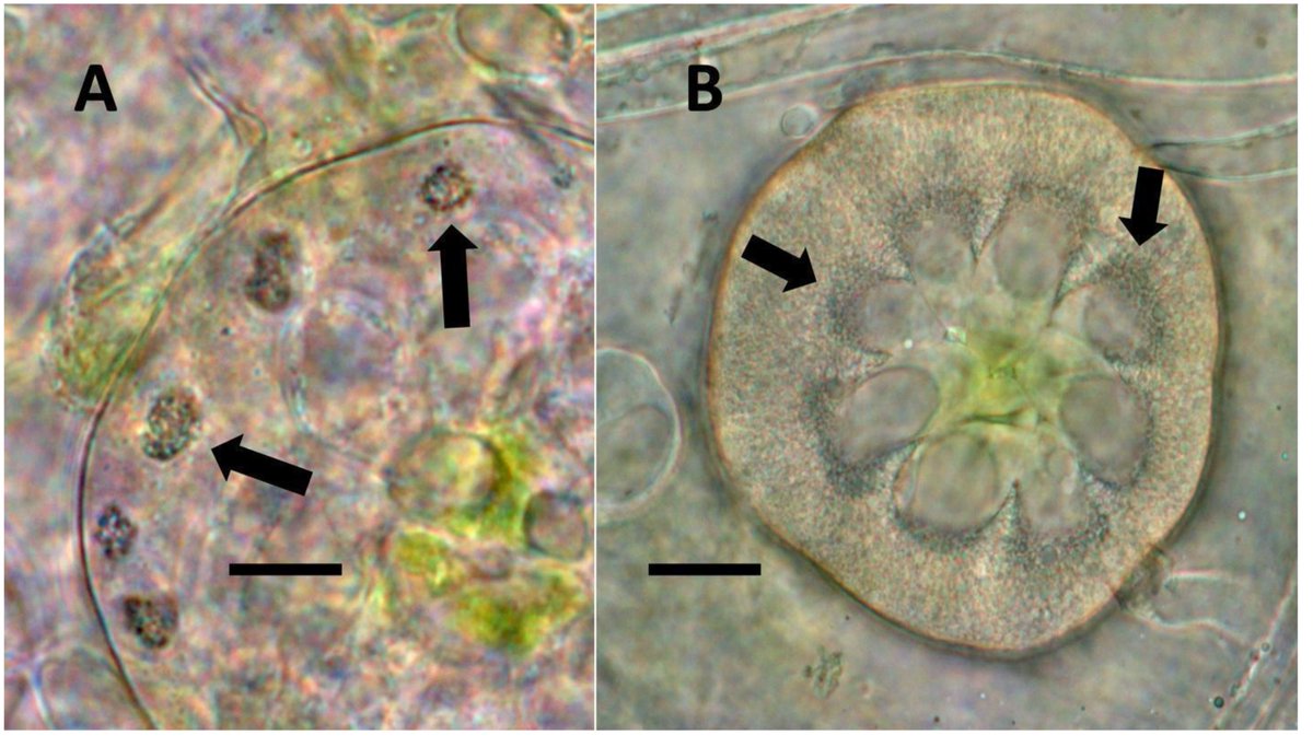 MedPlantChem's tweet photo. Check it out! Glandular trichomes of Cannabis sativa (hemp) stained to show superoxide (blue-purple color) around clusters of bacteria (arrows) (Bar = 10 um). https://t.co/jzLb6TBwHp 
Linsey Park (Medicinal Plant Chemistry ’21) is an author on the paper! https://t.co/YxiWaA2bAM