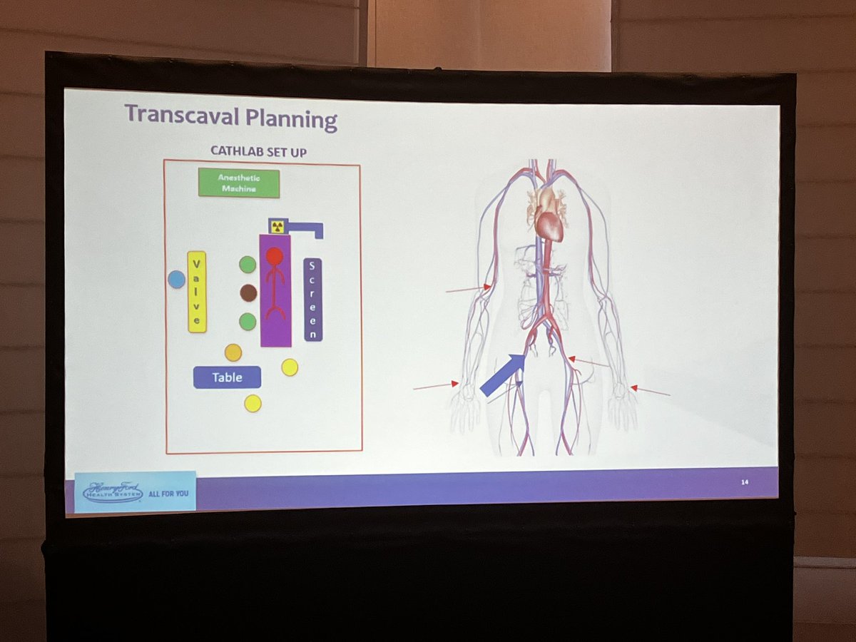 SCAI's tweet image. .@PedroMDMSc, FSCAI leads a small group session at #SCAISHOCK 2022 on performing elective or ad hoc #transcaval for urgent cases that require MCS.
