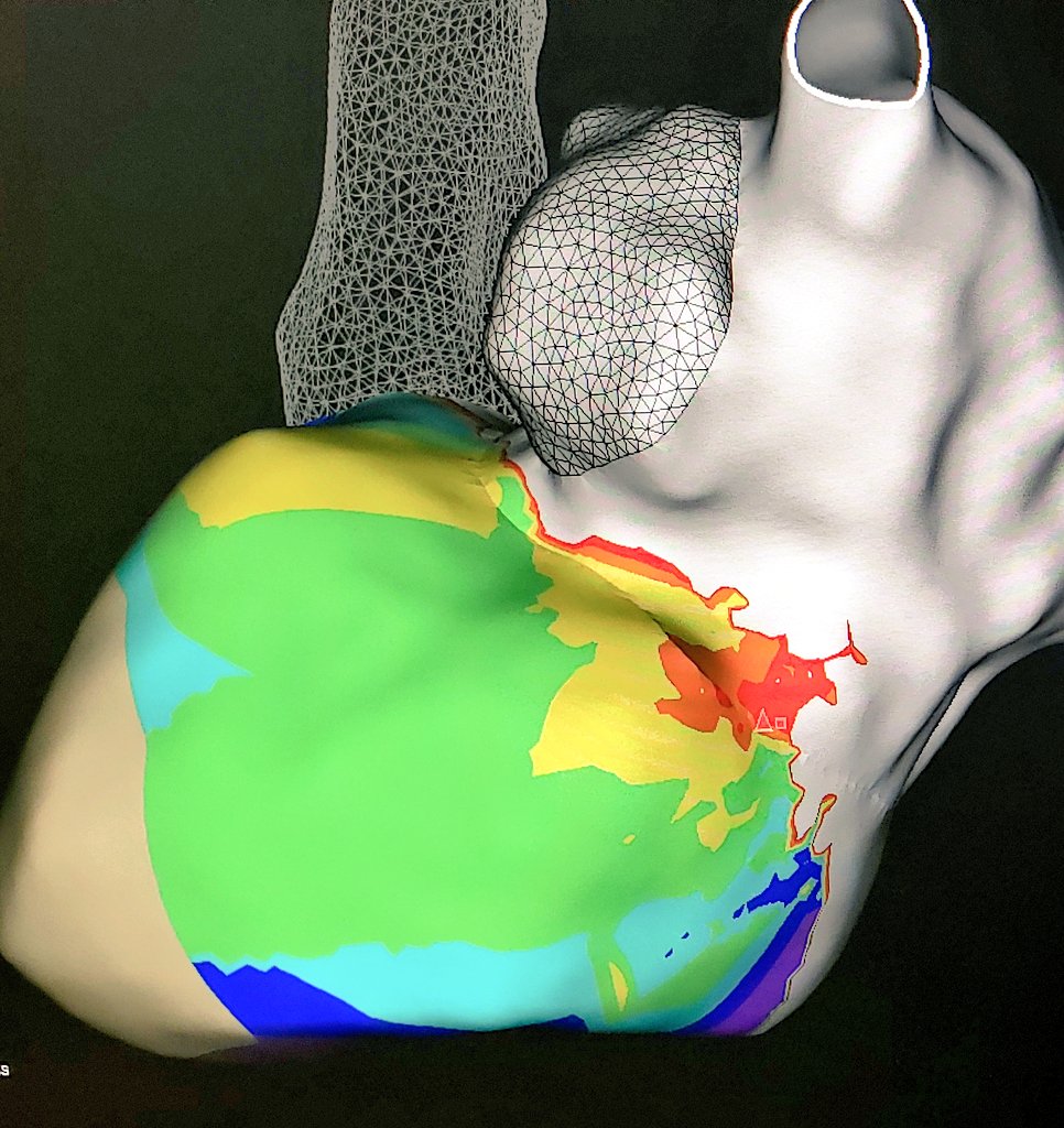 Josh Shriver tweet media
