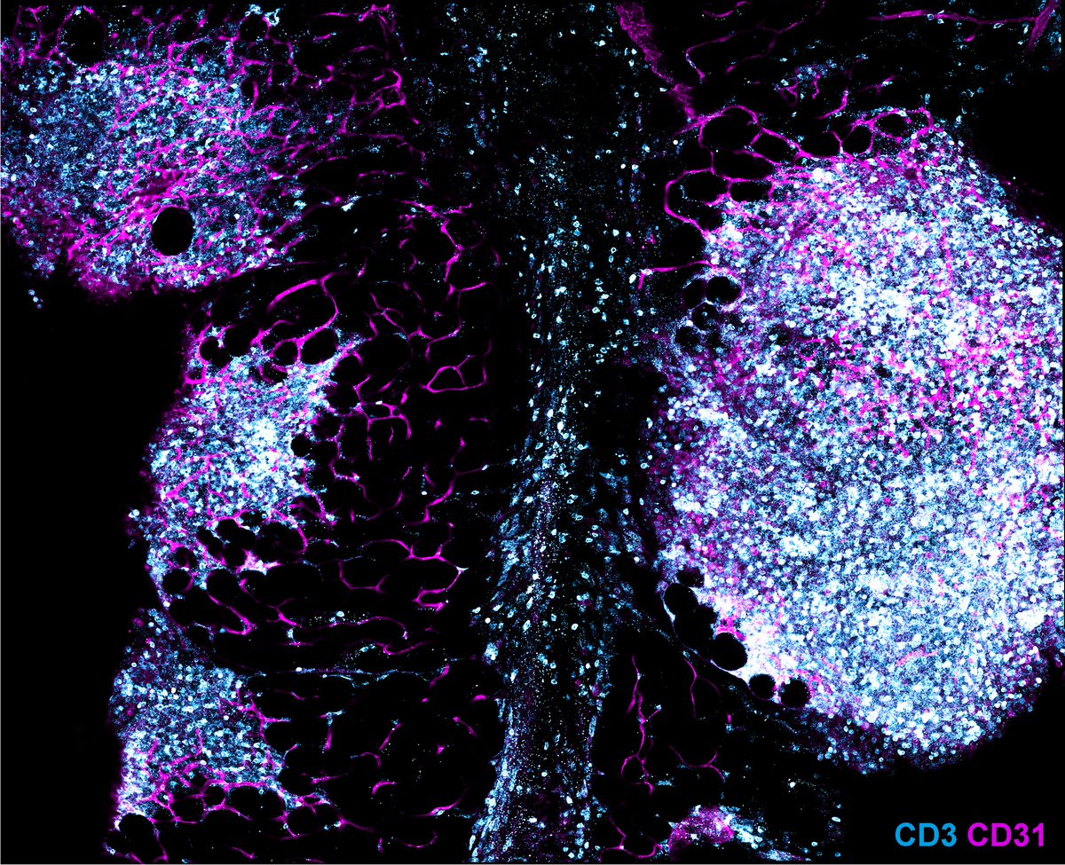 DavidESanin's tweet photo. 1/
Have you wondered how your body’s adipose tissue helps during infection?

We found that the conversation between Th2 and stromal cells drives remodelling of intestinal fat to protect the host. Read all about here 🧵 and check our paper! @SciImmunology https://t.co/1R2iRlMSFC https://t.co/wHpm23mGnO