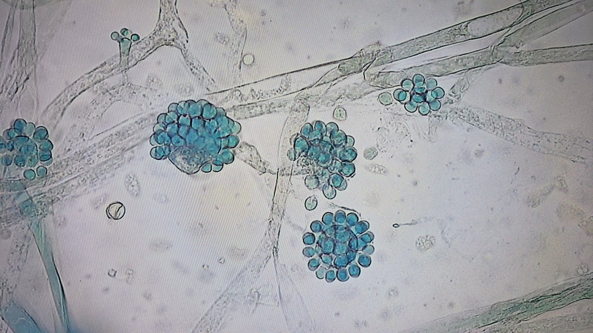 Linoj Samuel. PhD, D(ABMM) tweet media