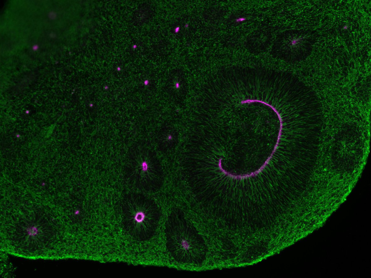aurelio_ortale's tweet photo. Very happy to contribute my first images to the #FluorescenceFriday ! 

I was right in time with my test staining for my final run of my internship at the @humantechnopole - thank @gtesta72 for the opportiunity and thanks to @SebastianoTrat for the organoids ! https://t.co/6GeMUt1rhh