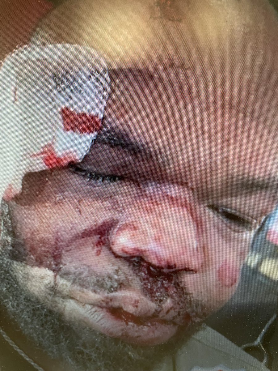 robmassonfox8's tweet photo. A civil lawsuit filed in Orleans court this afternoon reveals new details about an alleged beating incident involving Alvin Kamara in Las Vegas earlier this year. Alleged victim Darnell green is suing the saints running back for $10 million. No comment so far from Kamara‘s atty https://t.co/tCqCVyqS7f