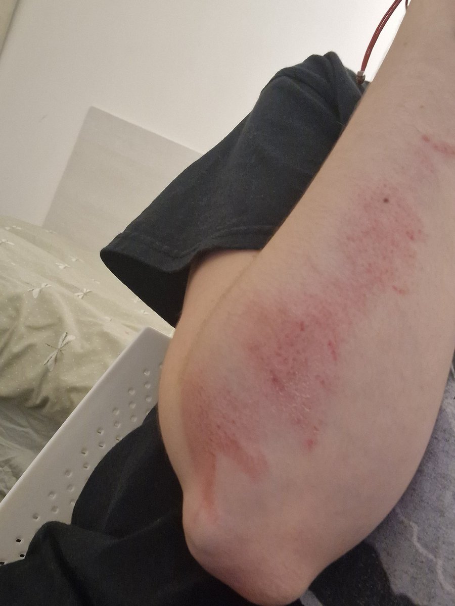 JessyEstreet's tweet photo. So I gymed and fell. Never again. Until next week. 🤕😏 https://t.co/NbOxzg8dm2