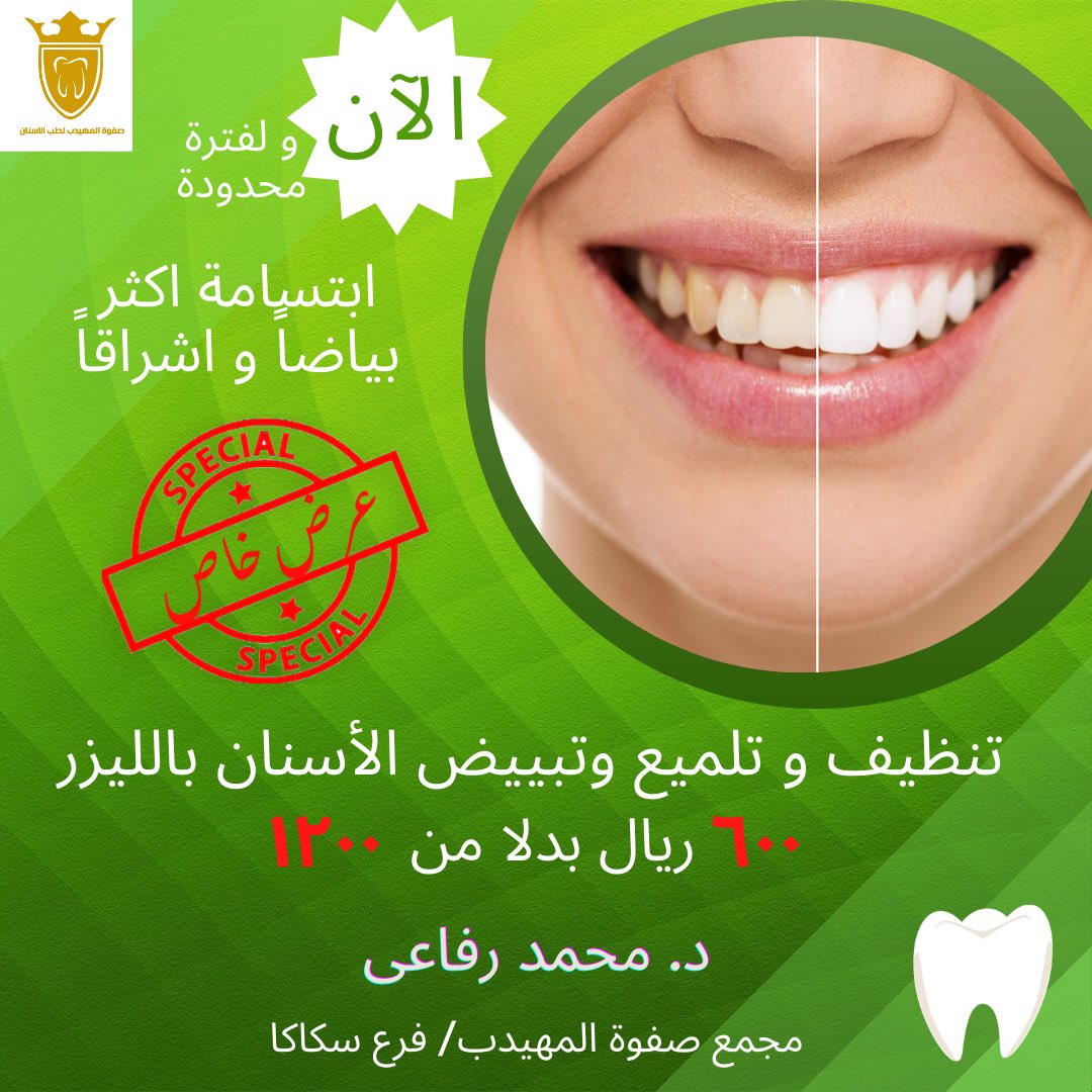 DrMohammedRefae's tweet photo. فى انتظاركم 

#عروض
#صفوة_المهيدب_لطب_الاسنان #تجميل #توحيد_صورة_ولي_العهد_في_تويتر #ابتسامة_هوليود #السيدة_الجليلة #ايماكس #فينيرز #عدسات #تركيبات_اسنان #سكاكا #جلسات_الخميس
#dentist #dental_clinic #smile #smilemakeover #sakaka #veneers_smile #crown #emax #emaxveneers #aesthetic https://t.co/tHlig8Uo24