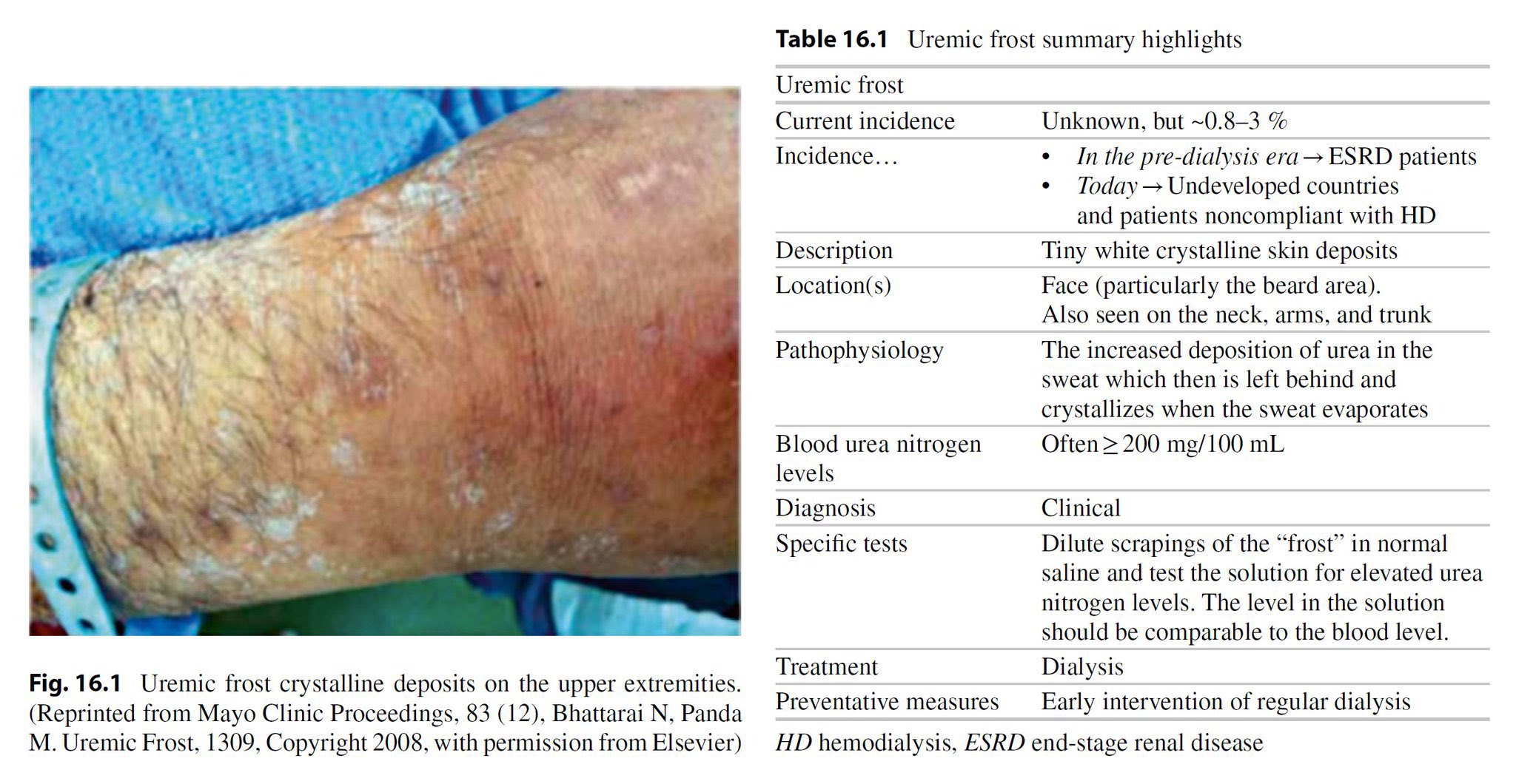 Uremic Rashes Uremic Frost On Skin Kidney Disease: How Does It Affect The Skin?