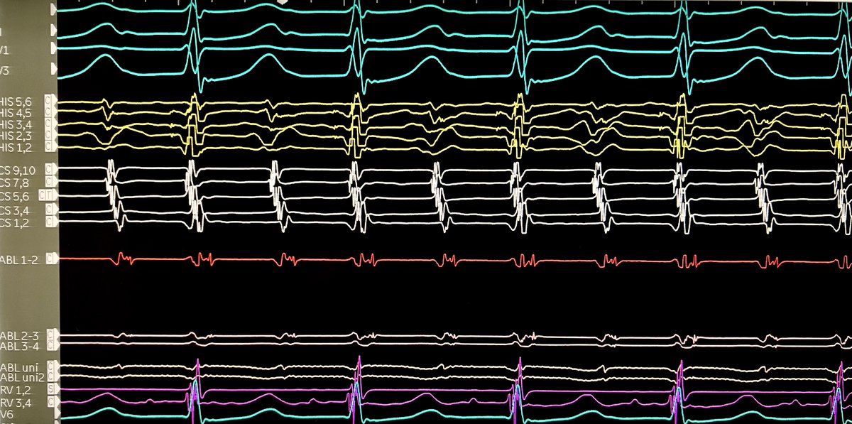 Jeffrey M Vinocur tweet media