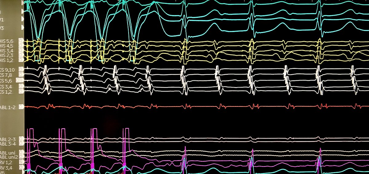 Jeffrey M Vinocur tweet media