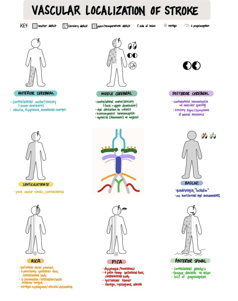 Andrew Micieli (@micielia_md) on Twitter photo Pictorial Review of Lesion Localization for Patients With Stroke
via <a href="/GreenJournal/">Neurology Journal</a> ne.neurology.org/content/1/1/e2…
#neurotwitter #stroke Pictorial Review of Lesion Localization for Patients With Stroke
via <a href="/GreenJournal/">Neurology Journal</a> ne.neurology.org/content/1/1/e2…
#neurotwitter #stroke