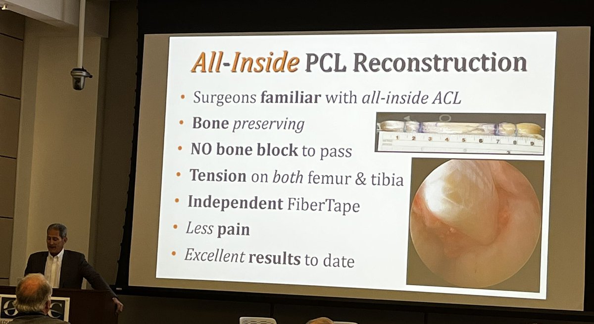 @MichaelStuartMD brings home PCL week w/@mayoclinicsport technique & data on all-inside single bundle reconstruction. #orthotwitter #knee @BruceALevyMD @DrKrych @MarioHevesiMD