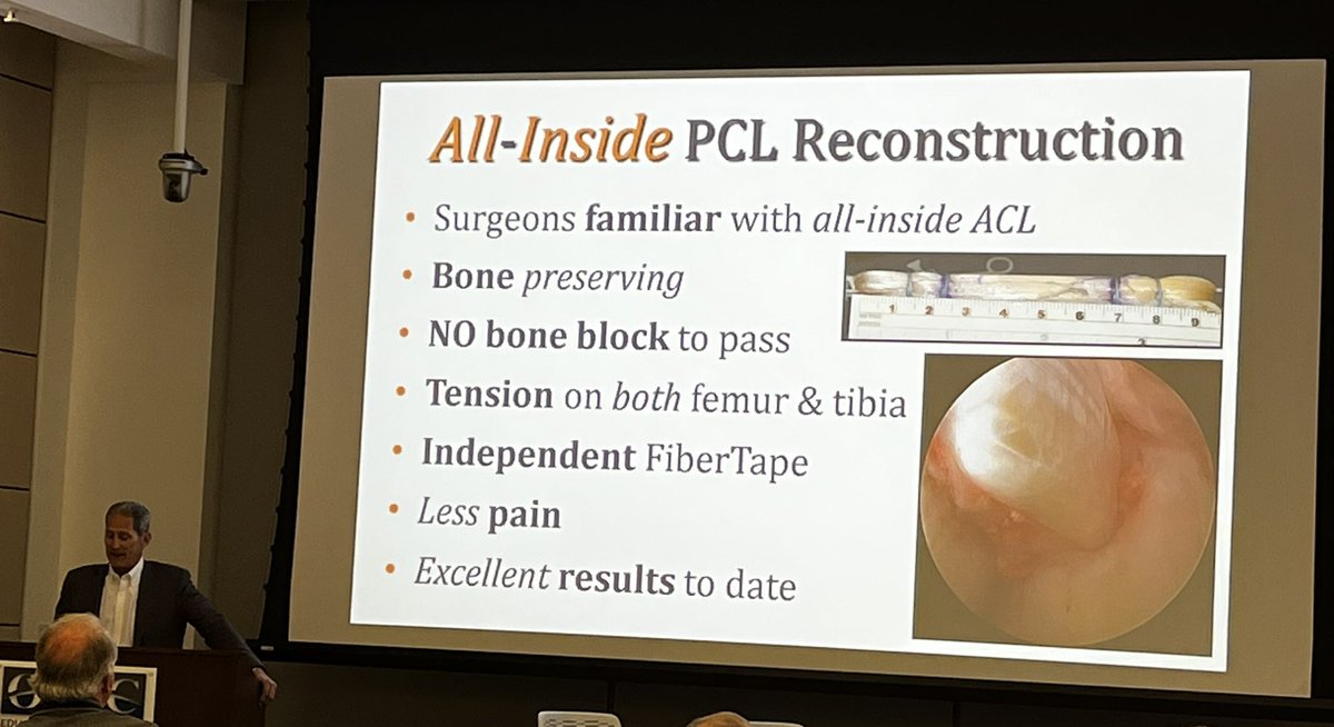 Clayton Nuelle, MD, FAAOS (@nuellesportsmd) on Twitter photo <a href="/MichaelStuartMD/">Michael J. Stuart</a> brings home PCL week w/<a href="/mayoclinicsport/">Mayo Clinic Orthopedics and Sports Medicine</a> technique & data on all-inside single bundle reconstruction. #orthotwitter #knee <a href="/BruceALevyMD/">Bruce A. Levy, MD</a> <a href="/DrKrych/">Dr. Aaron J. Krych</a> <a href="/MarioHevesiMD/">Mario Hevesi MD PhD</a> <a href="/MichaelStuartMD/">Michael J. Stuart</a> brings home PCL week w/<a href="/mayoclinicsport/">Mayo Clinic Orthopedics and Sports Medicine</a> technique & data on all-inside single bundle reconstruction. #orthotwitter #knee <a href="/BruceALevyMD/">Bruce A. Levy, MD</a> <a href="/DrKrych/">Dr. Aaron J. Krych</a> <a href="/MarioHevesiMD/">Mario Hevesi MD PhD</a>