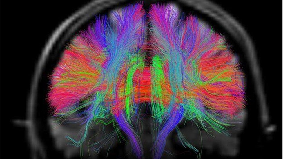GVillage_School's tweet image. This headline gets progressively more bonkers with each successive word:
buff.ly/3T79bxZ
#ai #stemcells #biologicalcomputing #sciencefiction #artificialintelligence