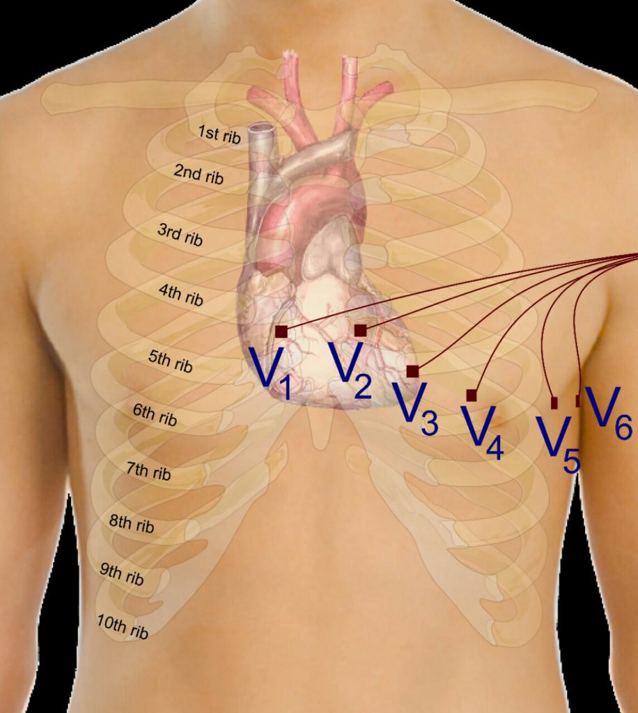 The Innovation Medicine on Twitter "Precordial leads in EKG"