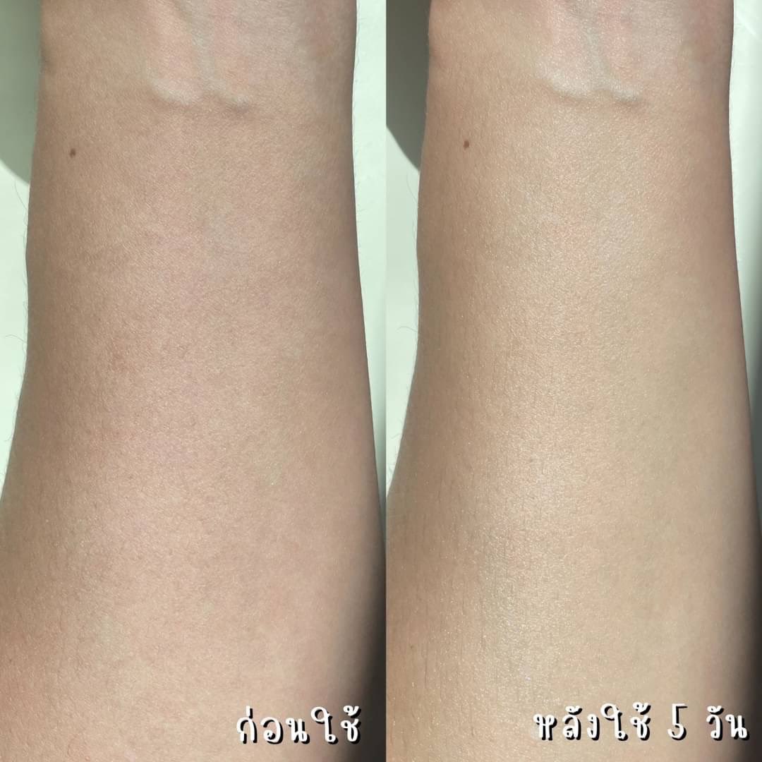 jjdoesitwork's tweet photo. ผิวหน้า��ึงแล้วผิวตัวต้องตึงด้วย Vaseline ไลน์ Pro Derma สูตรเบอร์6 ขวดม่วง ส่วนผสมตรงจุดมาก มาแบบเข้มข้นเลย เน้นเฟิร์มกระชับ คือเริชมาก ช่วยให้ผิวกระชับขึ้น เกลี่ยง่ายไม่หนักผิวเลย ที่สำคัญเหมาะกับทุกสภาพผิวรวมถึงผิวที่แพ้ง่าย ขอลงลึกส่วนผสมเค้าหน่อย(ต่อ)
#วาสลีนบอดี้แอมพูลโลชั่น https://t.co/KZxwHFIgha