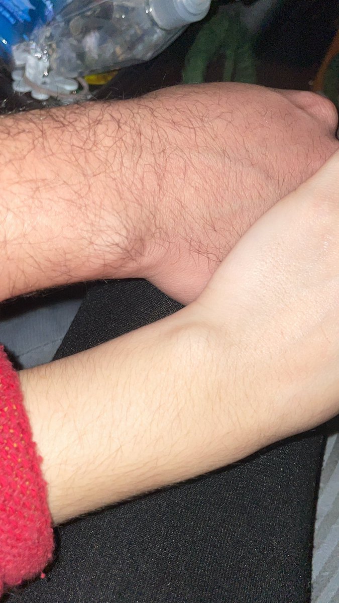 “Hand ankle bone”