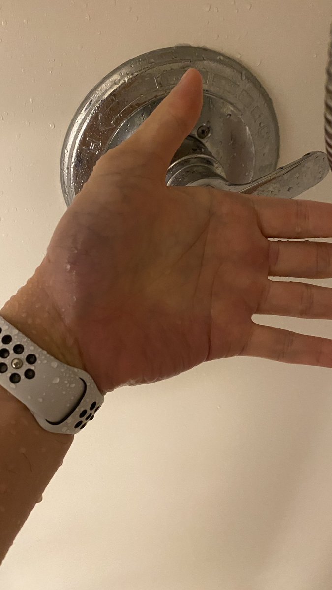 gmmoneyETH's tweet photo. Day4/7, my veins are in BleU. https://t.co/bpNIykahfF