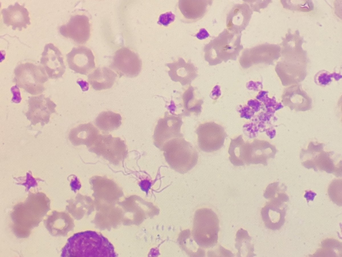 Swathiprabhu5's tweet image. Platelets with numerous projections on its surface🧐